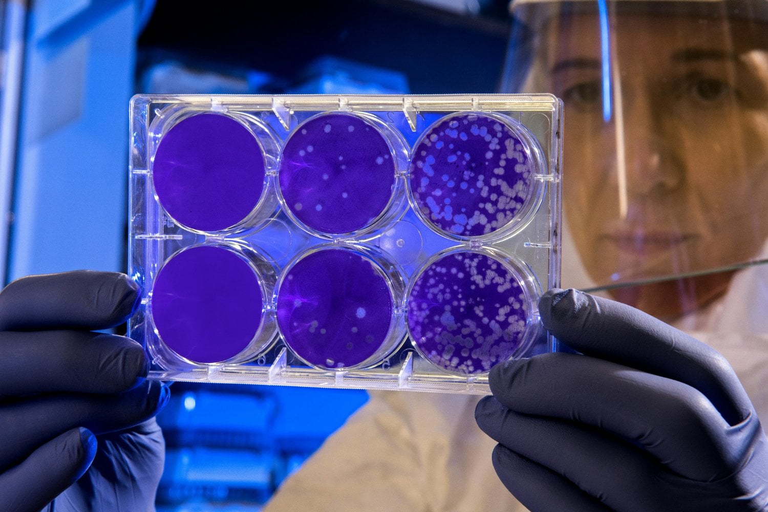Bacterias
