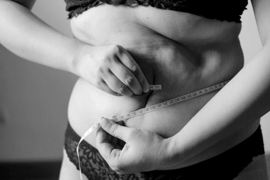 Obesidad