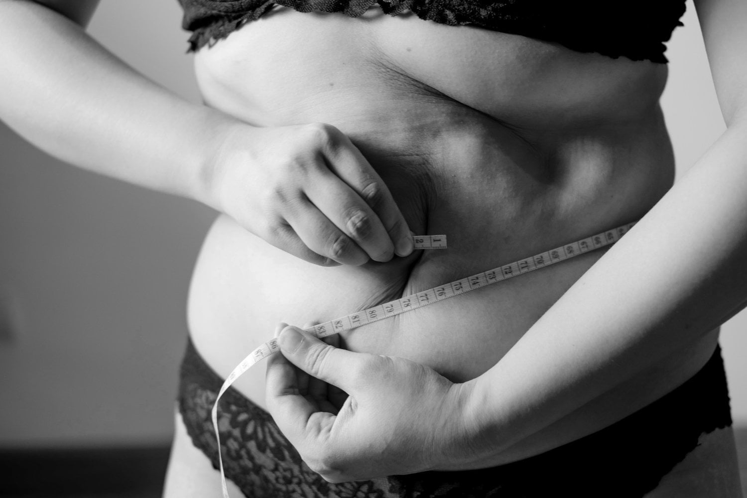 Obesidad