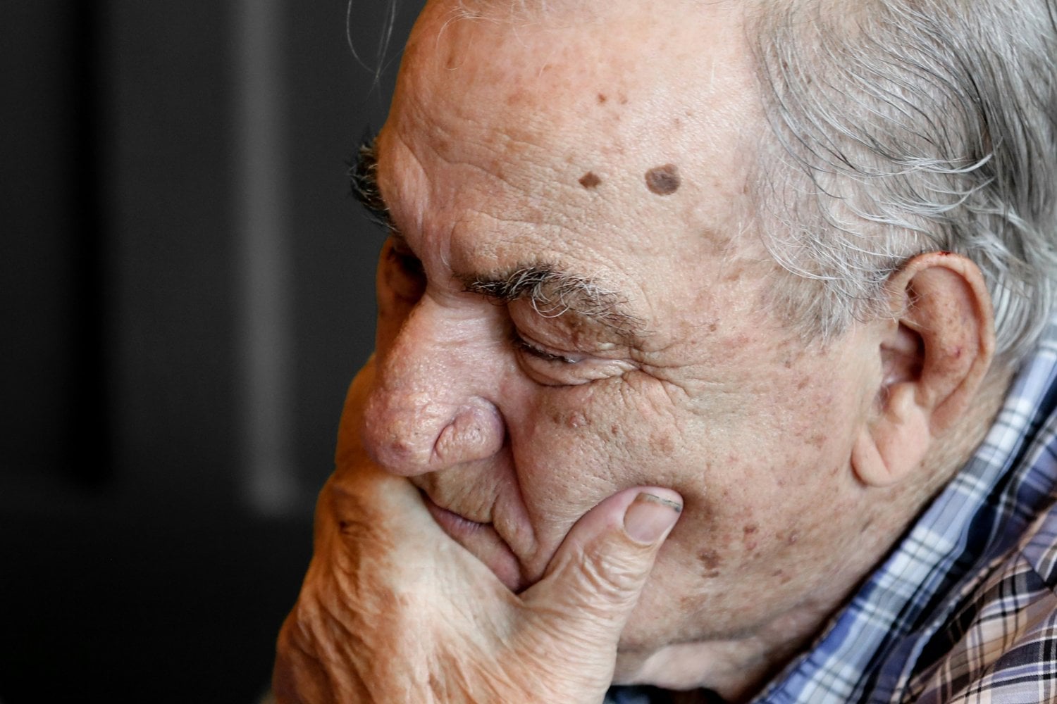 Signos De Alzheimer