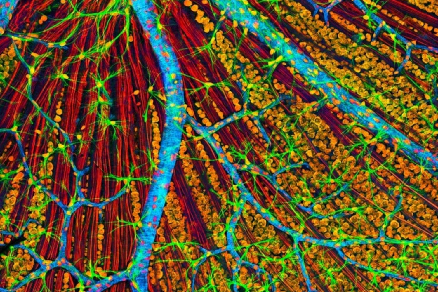 La primera terapia genética diseñada para rejuvenecer células humanas ya ha sido administrada a un paciente. El ensayo comienza en personas con glaucoma y busca reparar neuronas del nervio óptico que hasta ahora se consideraban irrecuperables