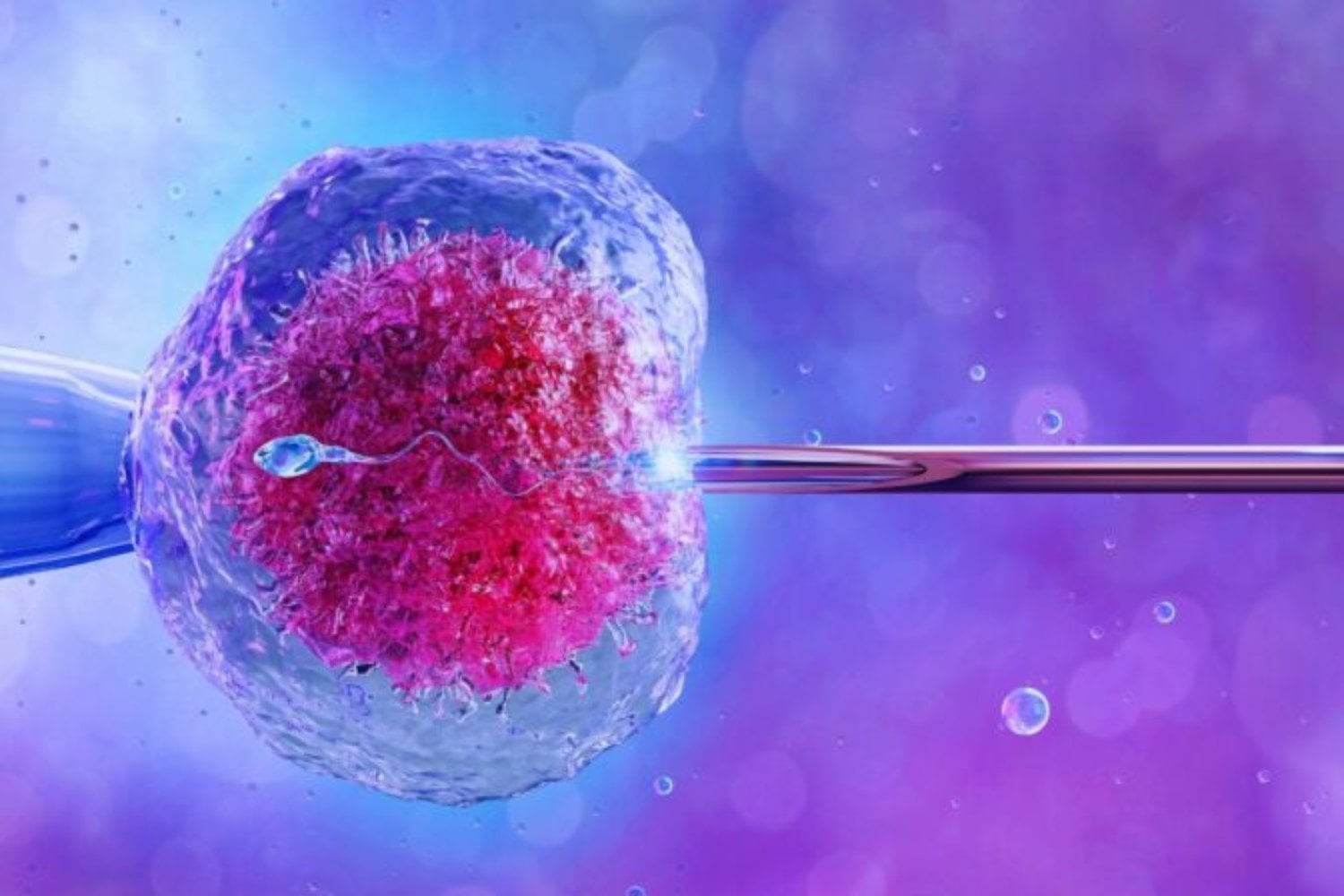 La primera terapia genética diseñada para rejuvenecer células humanas ya ha sido administrada a un paciente. El ensayo comienza en personas con glaucoma y busca reparar neuronas del nervio óptico que hasta ahora se consideraban irrecuperables