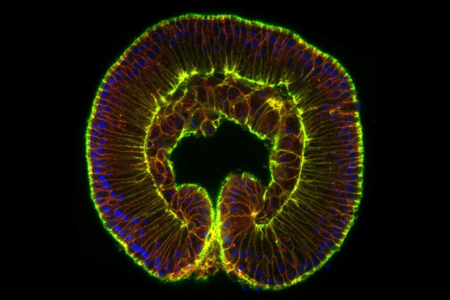 Los científicos repitieron un experimento histórico en una de las ramas más antiguas del árbol animal y obtuvieron una criatura con dos bocas. Después trasladaron sus células a una anémona y comprobaron que ambas entendían el mismo lenguaje molecular