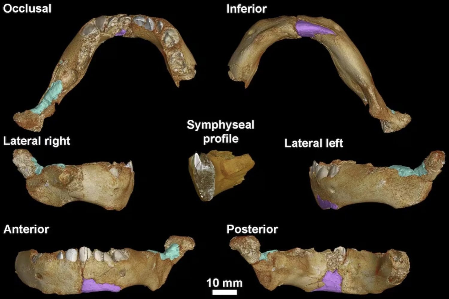 Amud 7, el bebé neandertal descubierto en Israel, tenía dientes de lactante pero huesos de un niño mucho más desarrollado. Esa diferencia apunta a una infancia más acelerada que la nuestra