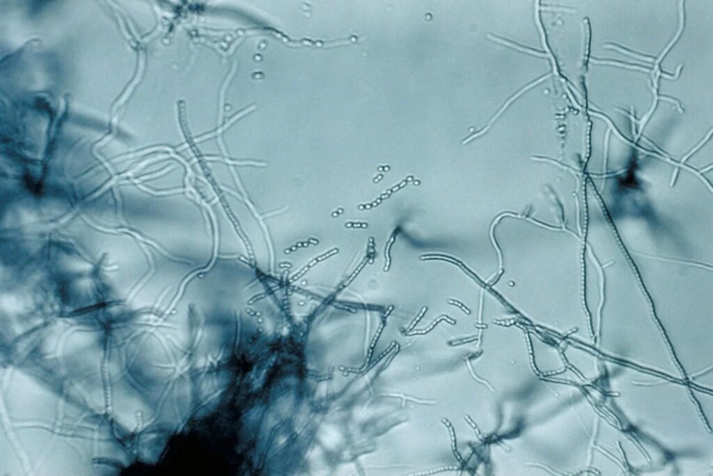 Bacteria