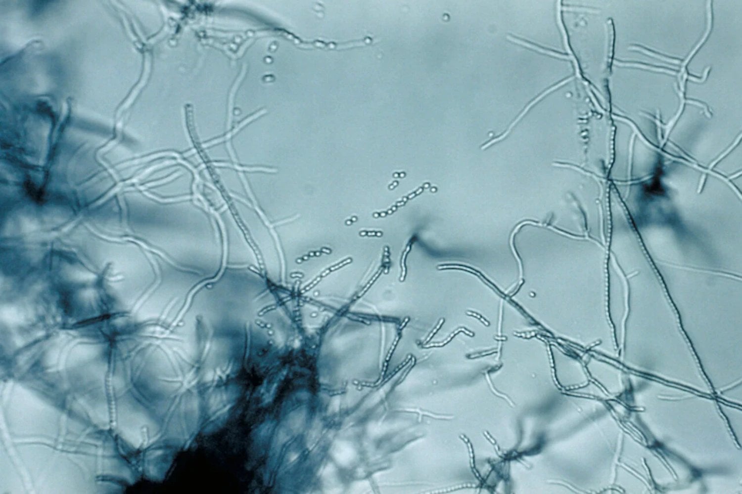 Bacteria