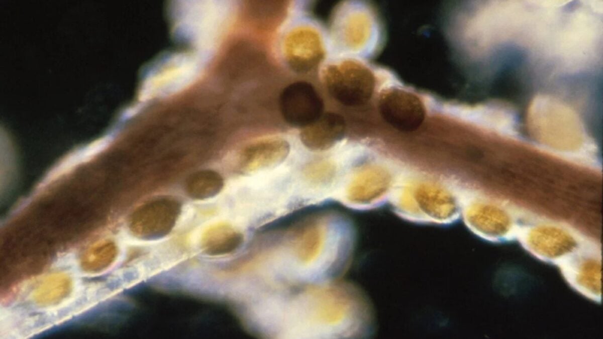 Más de 1.200 personas se intoxicaron por comer pescado y mariscos contaminados con toxinas de algas en EE.UU. en 12 años, y los CDC dicen que es solo la punta del iceberg