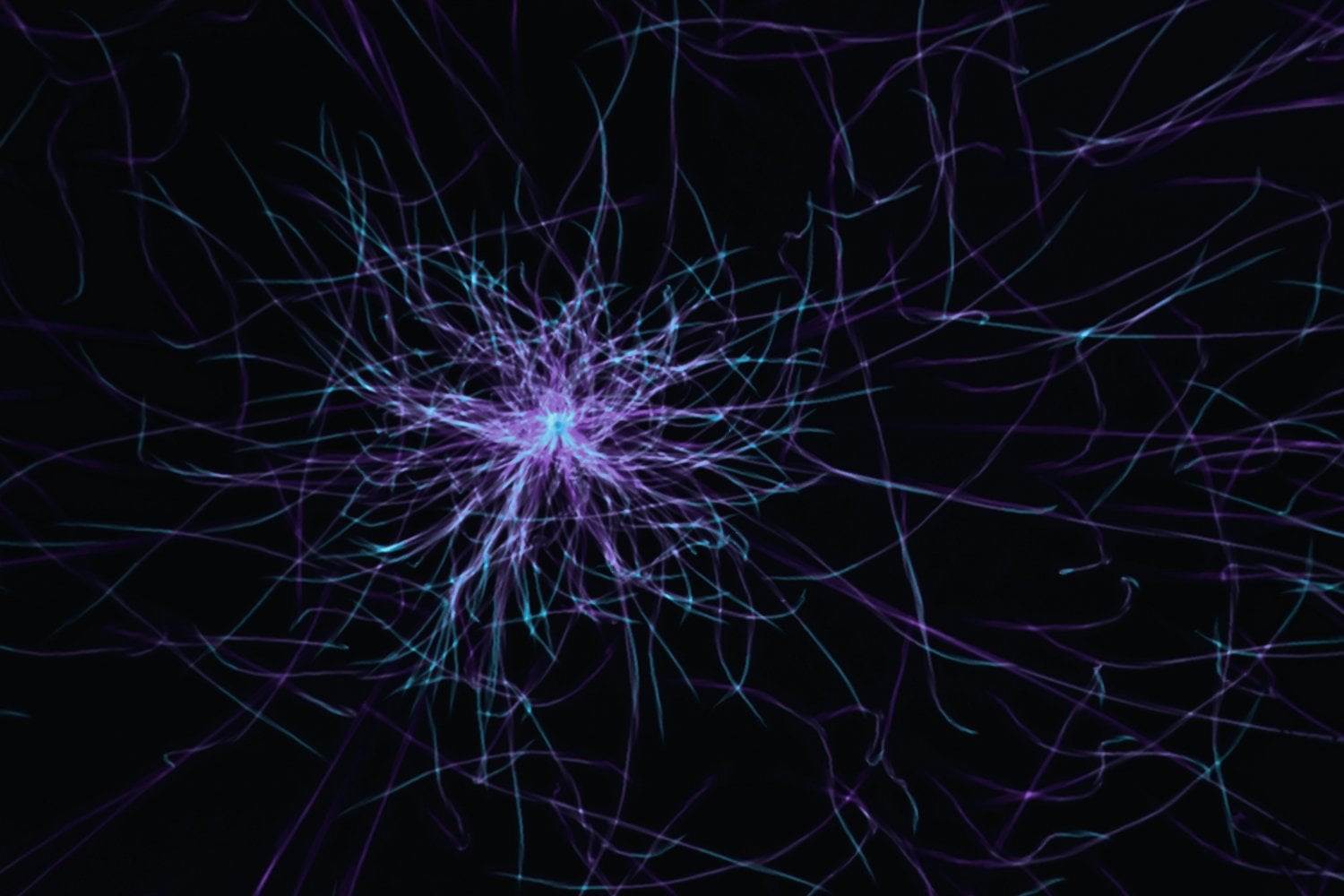 Neuronas