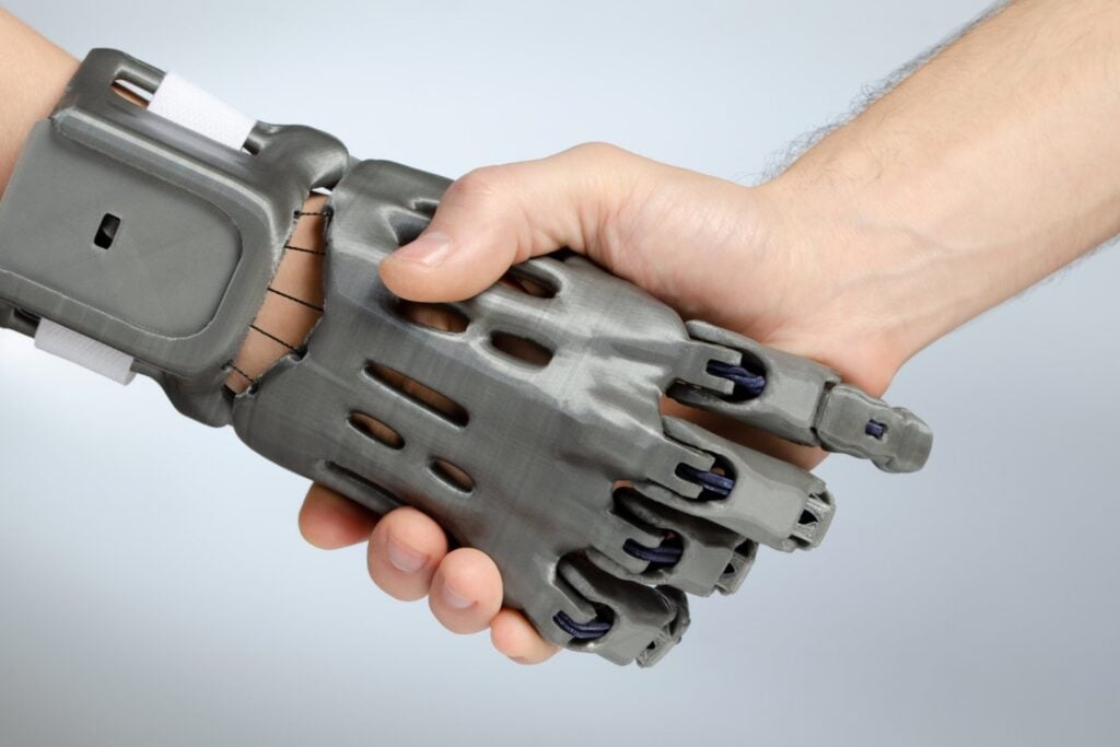 Protesis Robotica