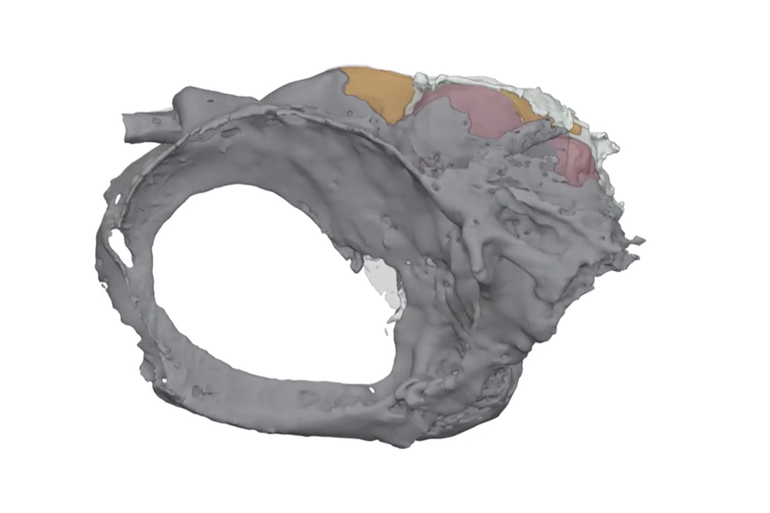 Un fósil de pez de más de 300 millones de años conservó algo que casi nunca sobrevive: su cerebro. Y eso puede cambiar cómo estudiamos la evolución de los vertebrados