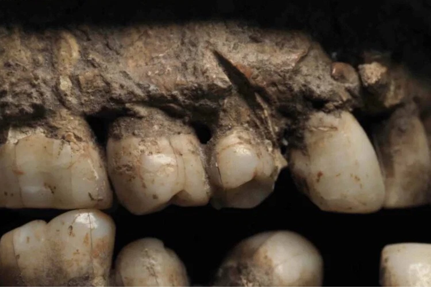 Una herida le atravesó la mandíbula y alcanzó uno de sus dientes hace más de 100.000 años. El hueso cicatrizó y podría esconder el apuñalamiento más antiguo conocido