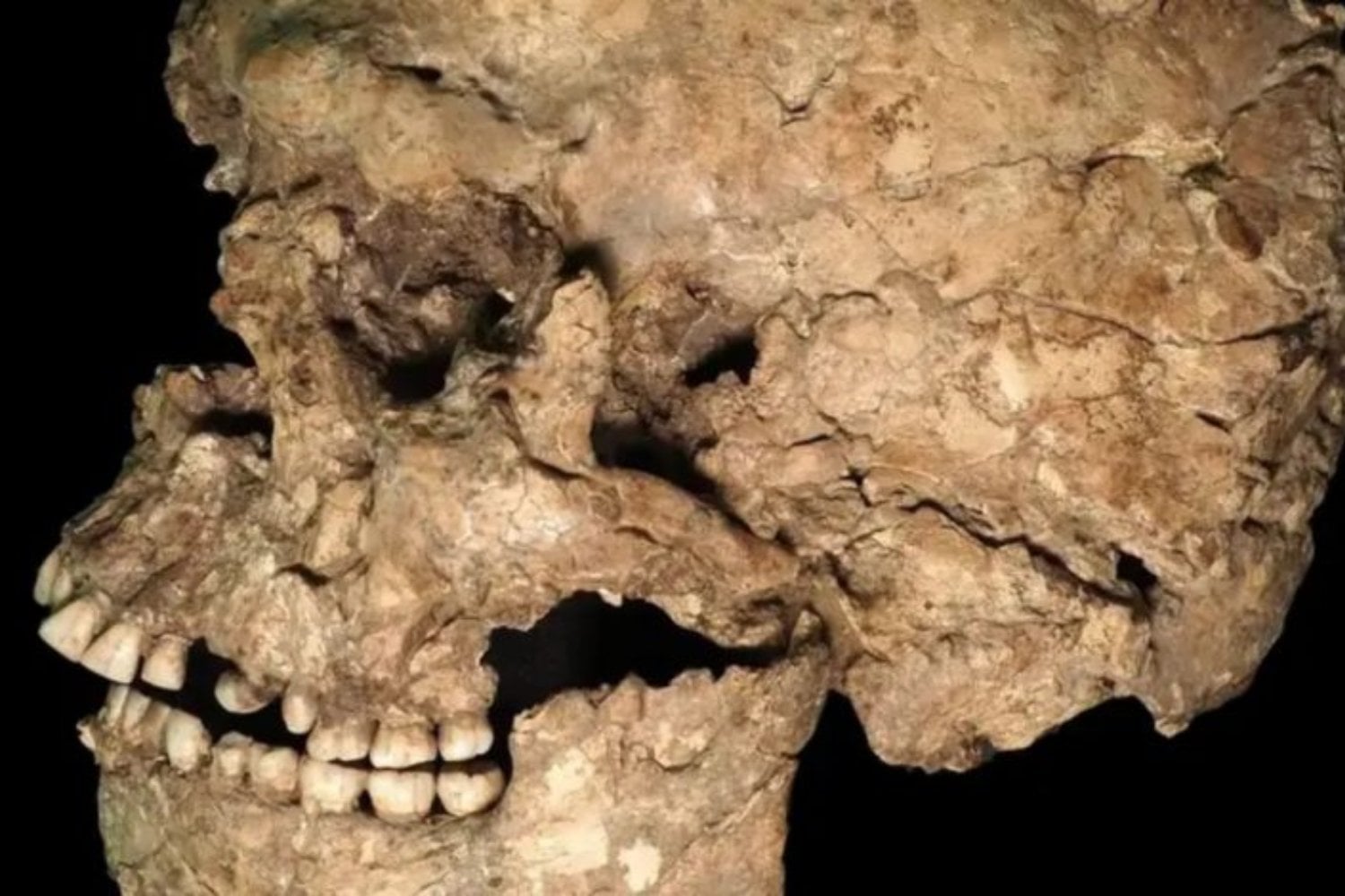 Una herida le atravesó la mandíbula y alcanzó uno de sus dientes hace más de 100.000 años. El hueso cicatrizó y podría esconder el apuñalamiento más antiguo conocido