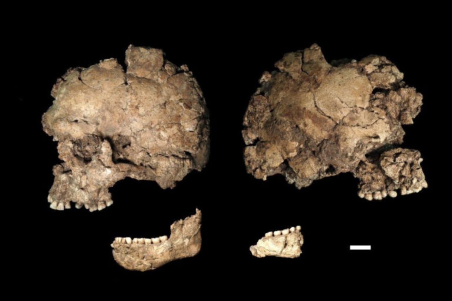 Una herida le atravesó la mandíbula y alcanzó uno de sus dientes hace más de 100.000 años. El hueso cicatrizó y podría esconder el apuñalamiento más antiguo conocido