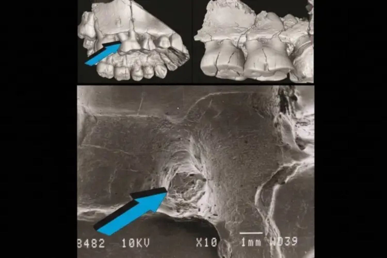 La evolución humana no solo dependió del cerebro y las herramientas. Una antigua enfermedad de las encías pudo ayudar a remodelar nuestras mandíbulas