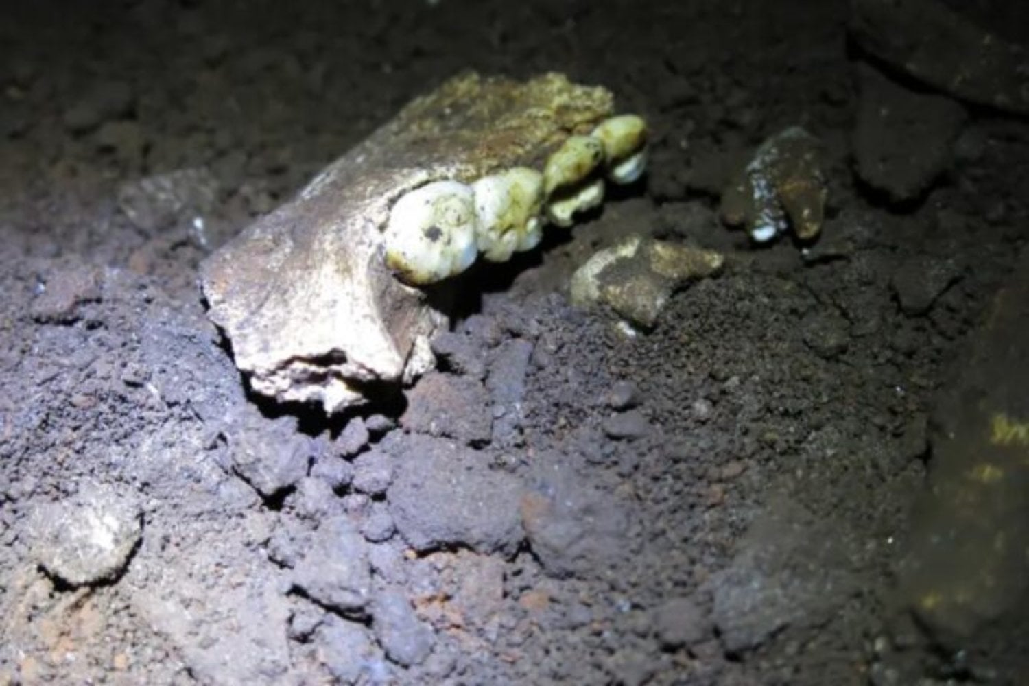 La evolución humana no solo dependió del cerebro y las herramientas. Una antigua enfermedad de las encías pudo ayudar a remodelar nuestras mandíbulas