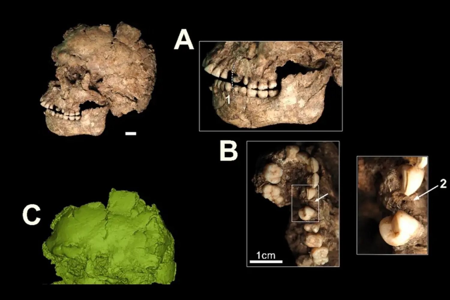Un cráneo hallado en una de las cuevas funerarias más antiguas acaba de revelar una escena brutal. Hace hasta 145.000 años, un humano sobrevivió a una herida causada por un objeto afilado
