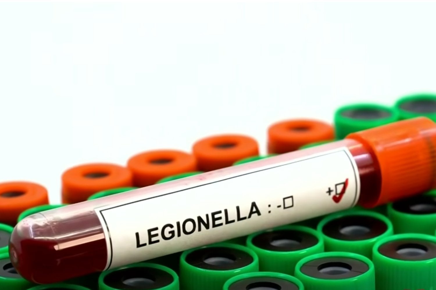 El brote mortal que preocupa a Nueva York: qué es la Legionella y cuáles son sus síntomas