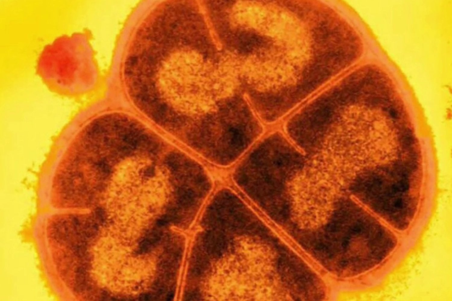 Marte podría convertir bacterias comunes en un problema mucho más peligroso para los astronautas