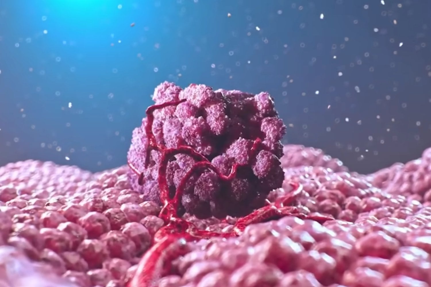 Científicos crean una técnica capaz de seguir el cáncer desde todo el cuerpo hasta una sola célula