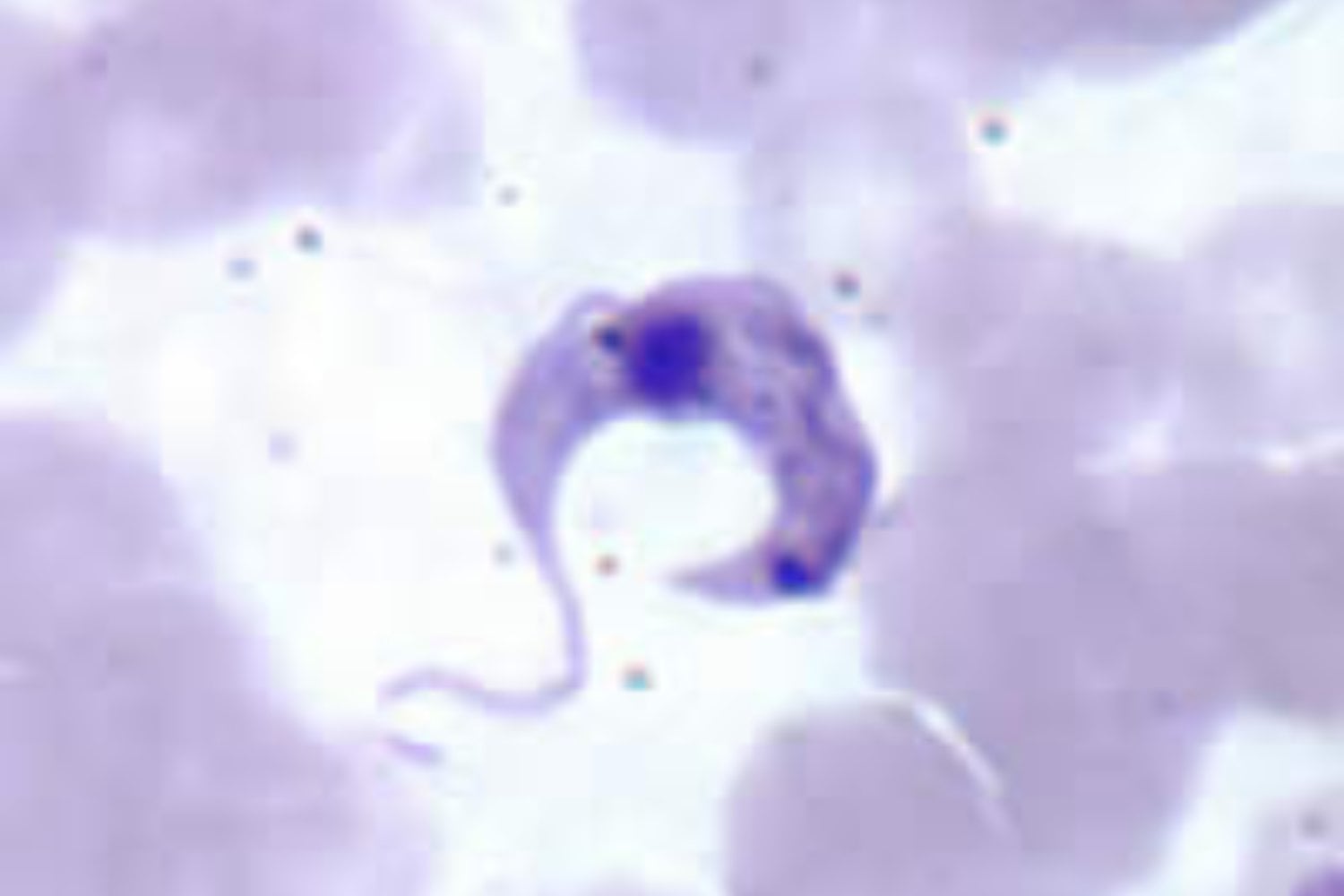 Trypasonoma Cruzi
