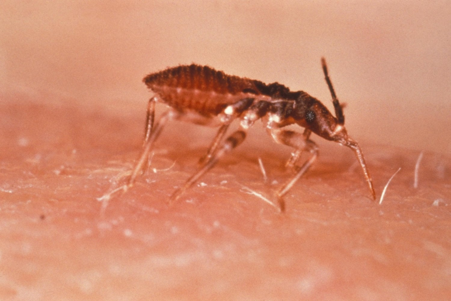 Vinchuca
