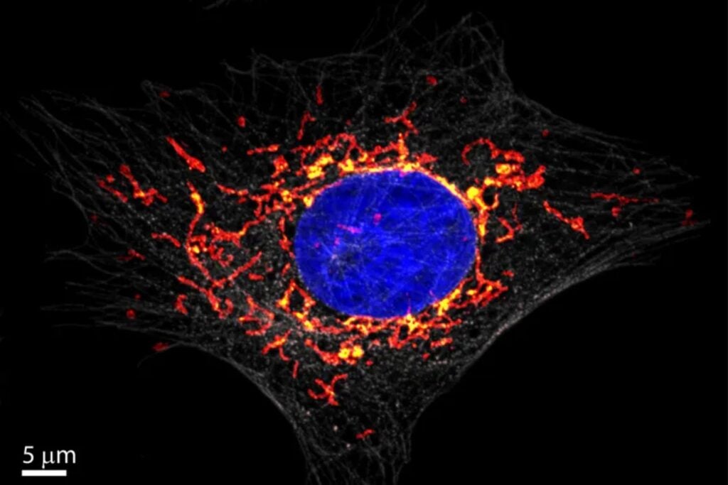 Los médicos sacaron 100 millones de mitocondrias de su pierna y se las inyectaron directamente en los ojos. Sus pupilas llevaban 71 días sin responder a la luz y reaccionaron en menos de 48 horas