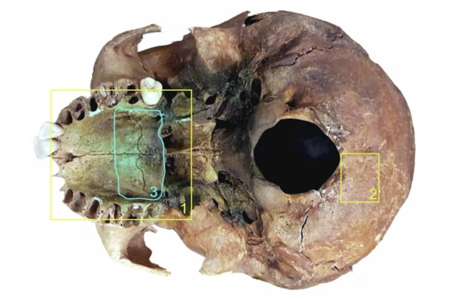 Ni siquiera muerta dejaron de temerle. La enterraron con seda, plata y oro, pero antes de que su cuerpo se descompusiera abrieron la tumba y dejaron una hoz sobre su garganta para que no volviera a la vida
