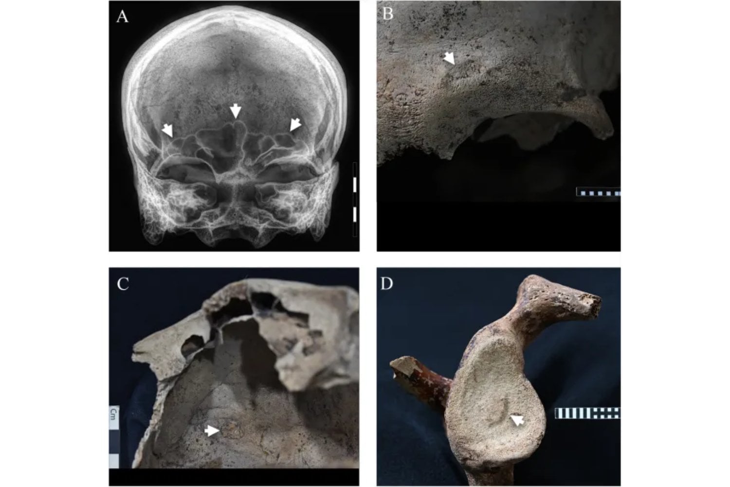 Las enterraron con arcos, flechas y una daga, pero durante más de un siglo se creyó que eran simples símbolos. Sus huesos sugieren que las princesas de Dahshur entrenaban hasta dejar marcas en el cuerpo