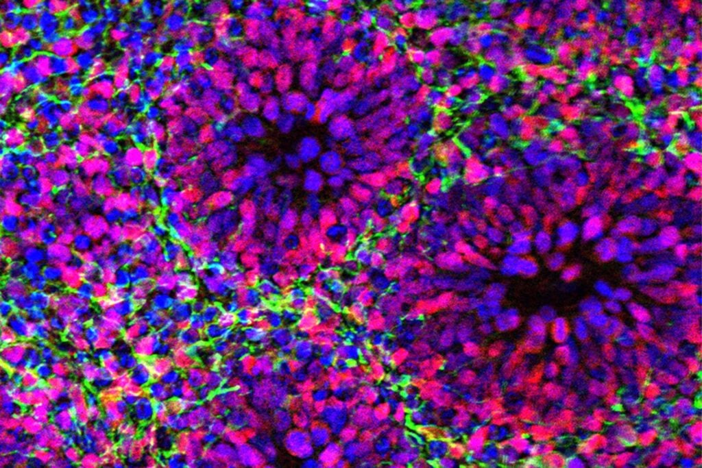 Harvard ha conseguido mantener “minicerebros” humanos vivos durante más de cinco años. Lo extraordinario no es que sobrevivan: sus células recuerdan cuánto tiempo ha pasado y siguen madurando como lo harían dentro de nosotros