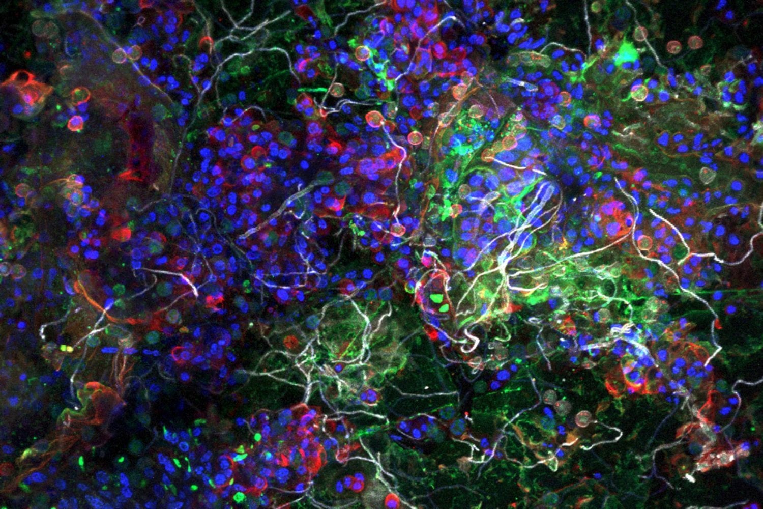 Llevamos décadas llenando el océano de plástico y la vida ha hecho algo que nadie planeó. Ha convertido nuestra basura en un nuevo ecosistema lleno de microbios mejor preparados para sobrevivir