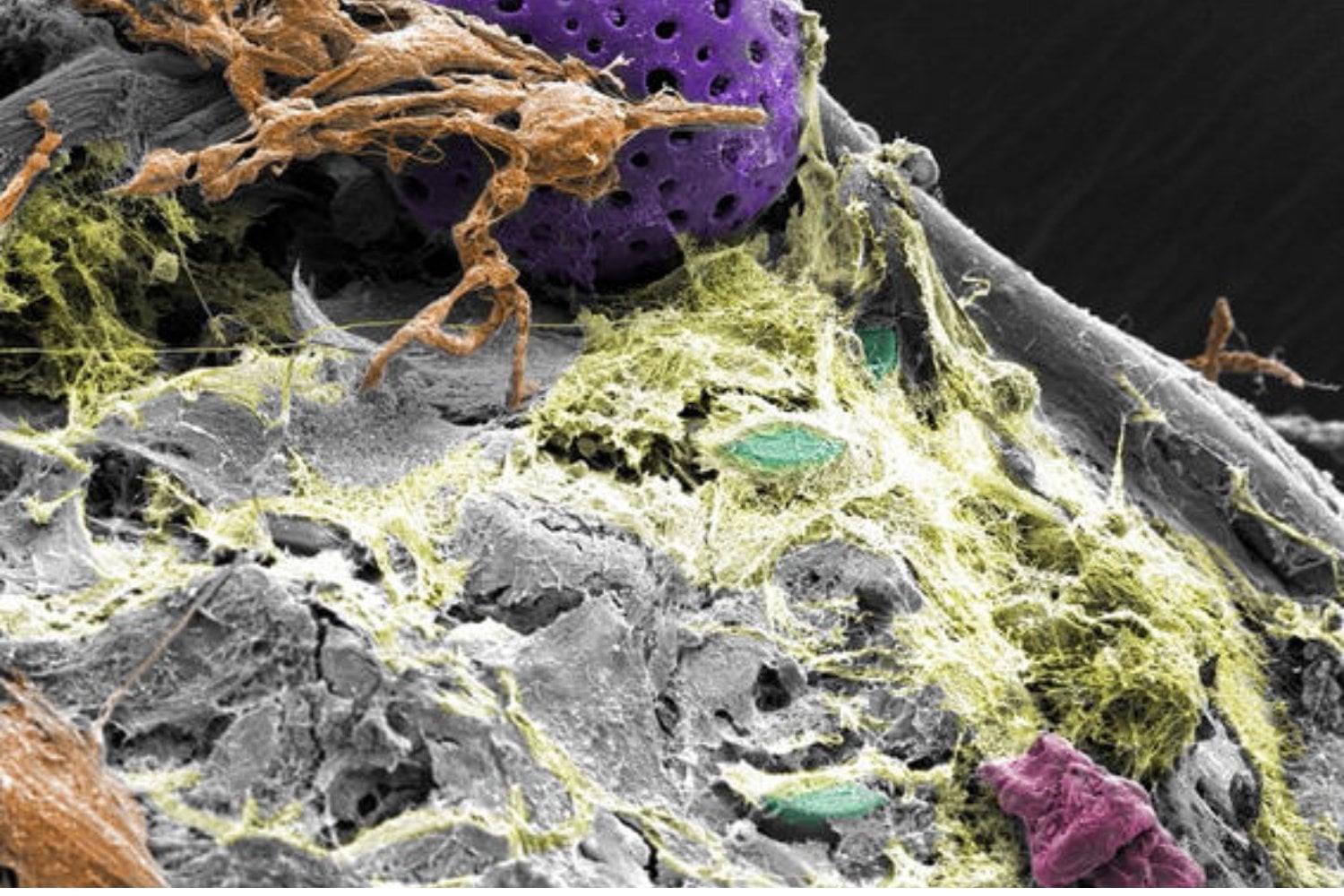 Llevamos décadas llenando el océano de plástico y la vida ha hecho algo que nadie planeó. Ha convertido nuestra basura en un nuevo ecosistema lleno de microbios mejor preparados para sobrevivir