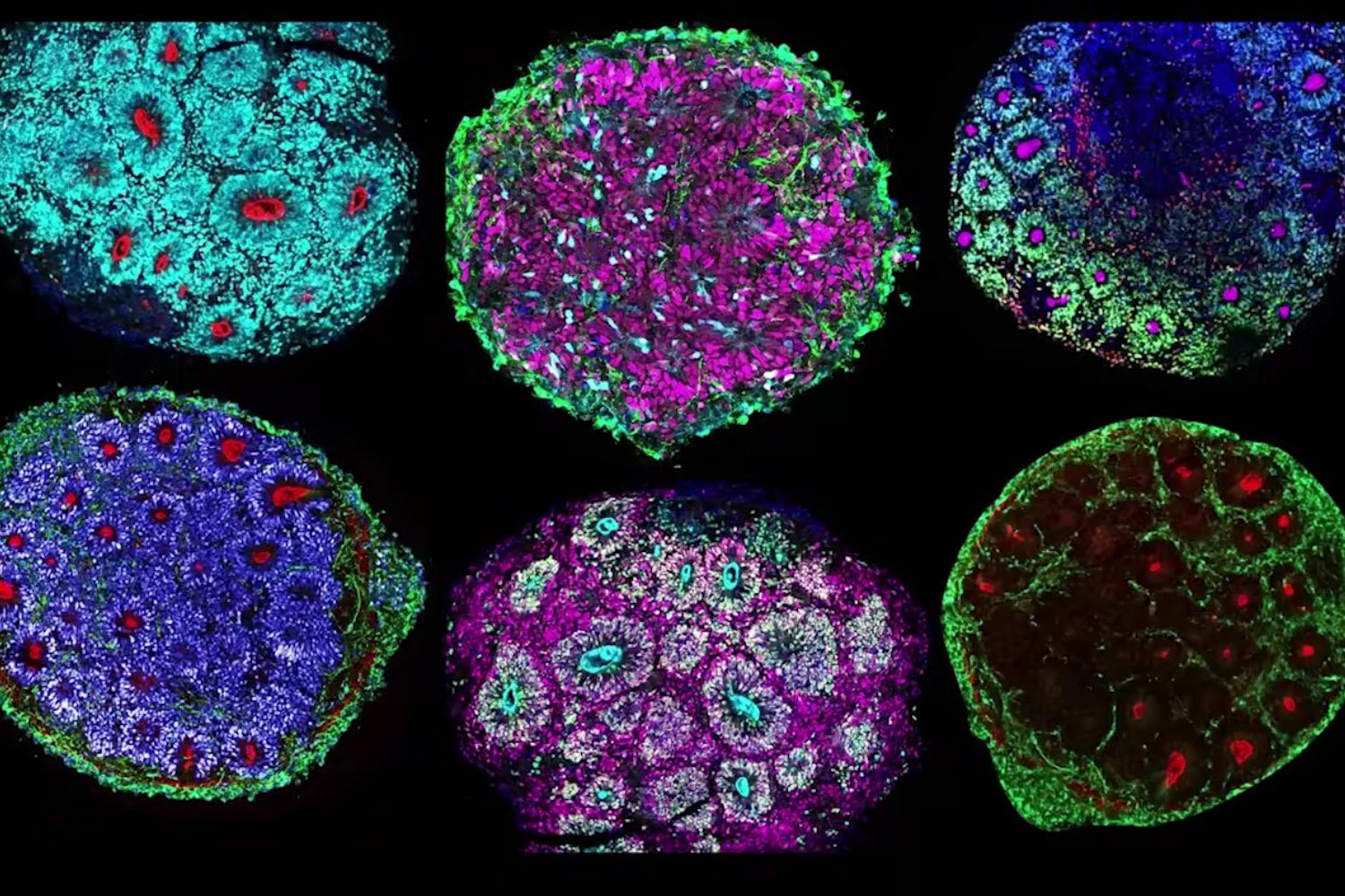 Científicos mantienen “minicerebros” humanos vivos durante cinco años y abren una nueva ventana al desarrollo cerebral
