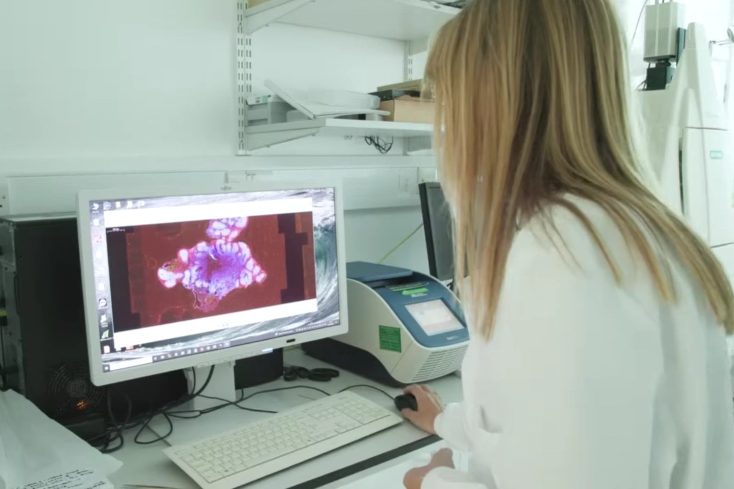 Científicos mantienen “minicerebros” humanos vivos durante cinco años y abren una nueva ventana al desarrollo cerebral