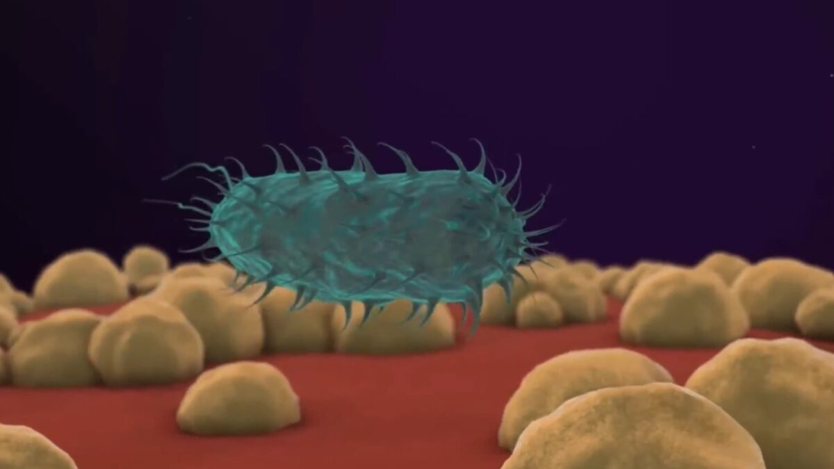 La llamada “bacteria comecarne” sigue siendo rara, aunque los mares cálidos aumentan el riesgo