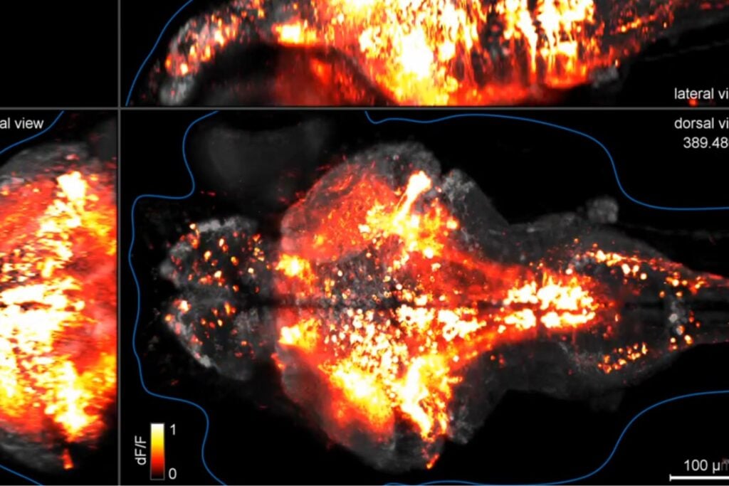 Científicos logran ver neuronas individuales trabajando en un cerebro casi en tiempo real