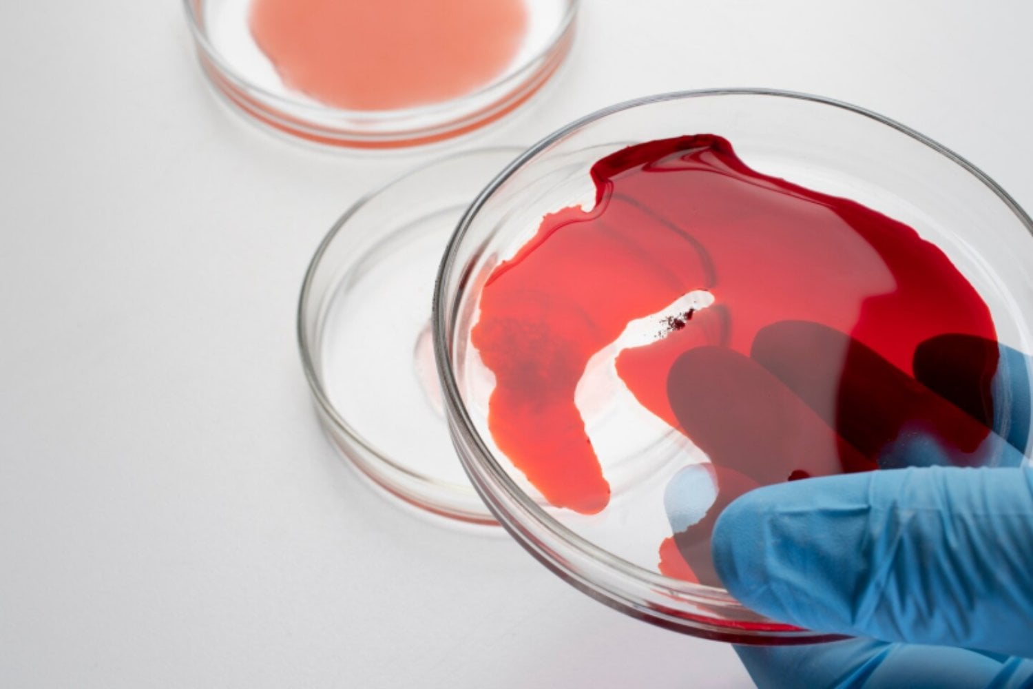 El aumento del CO2 ya deja rastros medibles en la sangre, según un estudio