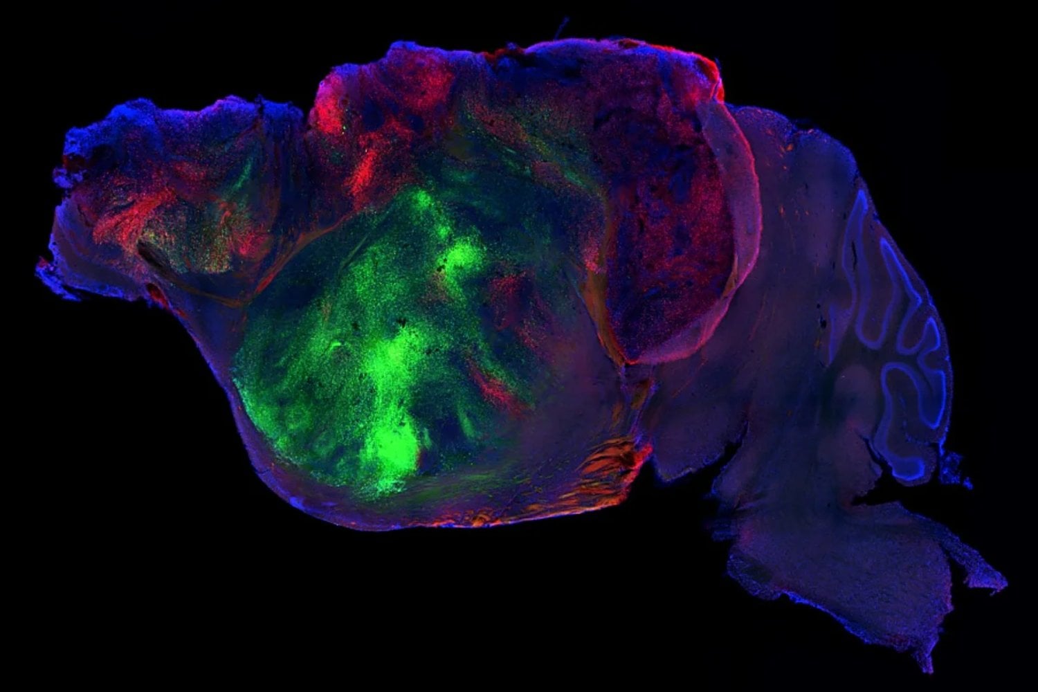 Le quitaron casi toda la corteza cerebral a ratones y la reemplazaron con tejido humano. Las neuronas se conectaron al cerebro, llegaron hasta la médula y recuperaron parte de las funciones perdidas