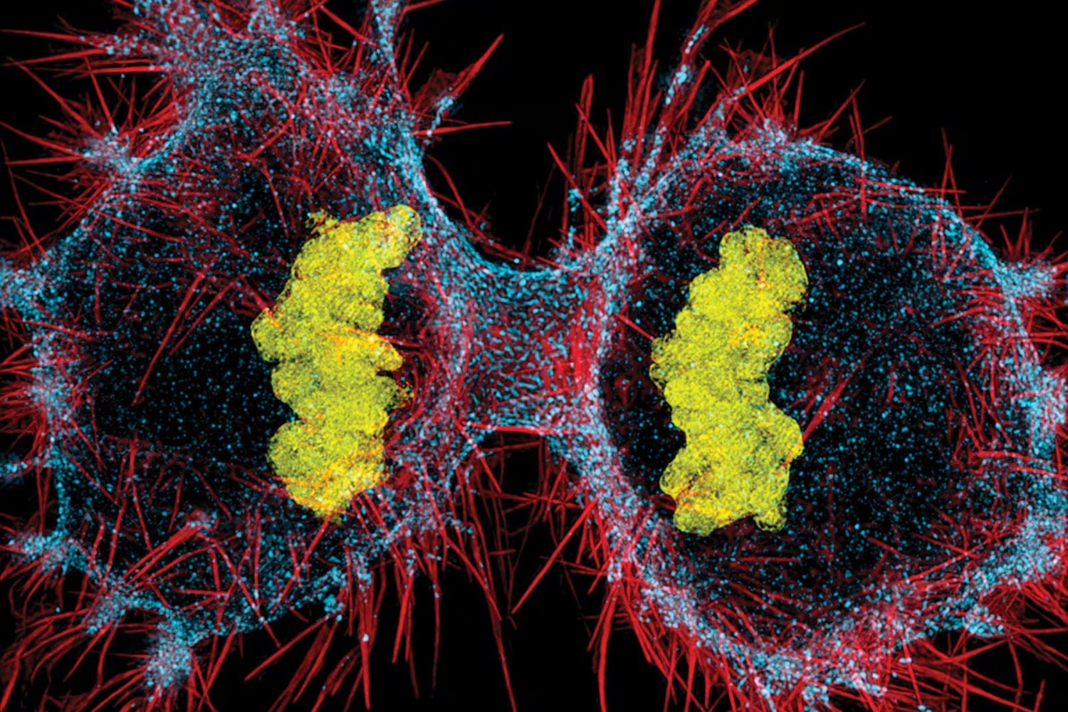 La IA acaba de cruzar una frontera de la biología: ya puede escribir genomas completos de virus funcionales. 16 diseños consiguieron infectar bacterias reales
