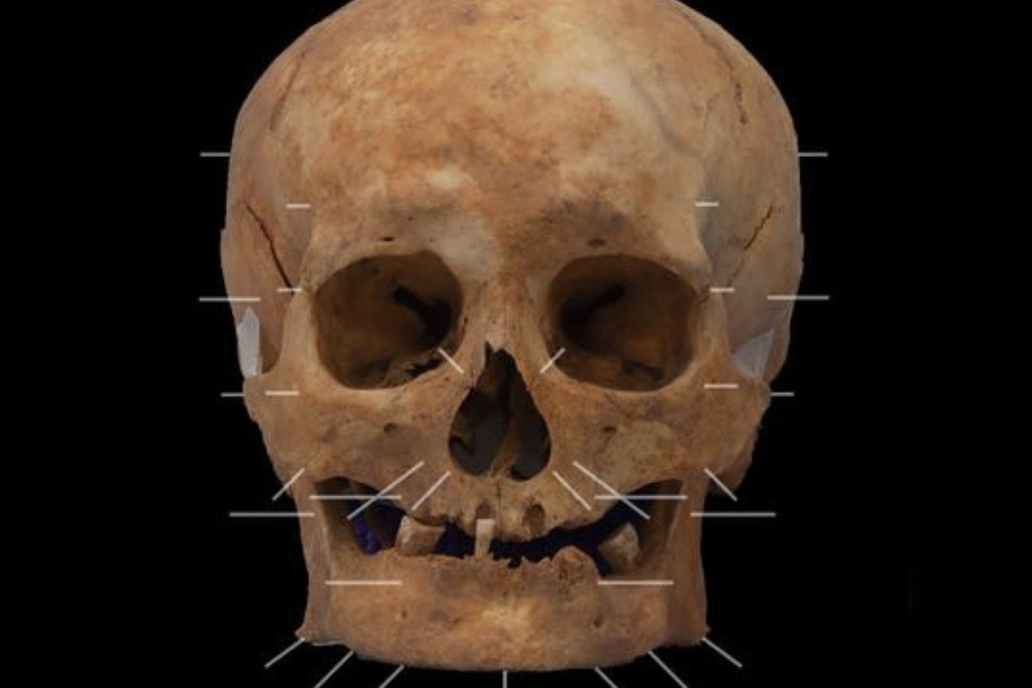 Nació bajo un rey vikingo y sobrevivió a la conquista que cambió Inglaterra para siempre. Casi 1.000 años después, la ciencia le ha devuelto el rostro