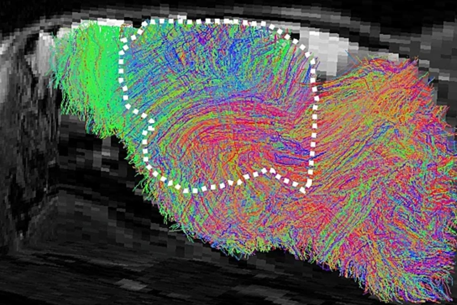 Le quitaron casi toda la corteza cerebral a ratones y la reemplazaron con tejido humano. Las neuronas se conectaron al cerebro, llegaron hasta la médula y recuperaron parte de las funciones perdidas