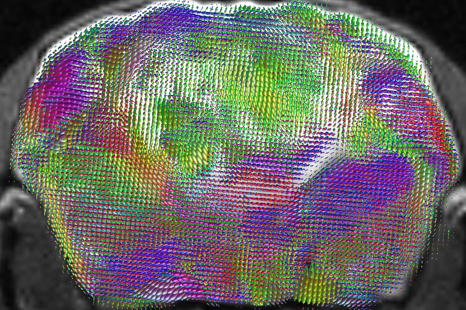 Le quitaron casi toda la corteza cerebral a ratones y la reemplazaron con tejido humano. Las neuronas se conectaron al cerebro, llegaron hasta la médula y recuperaron parte de las funciones perdidas
