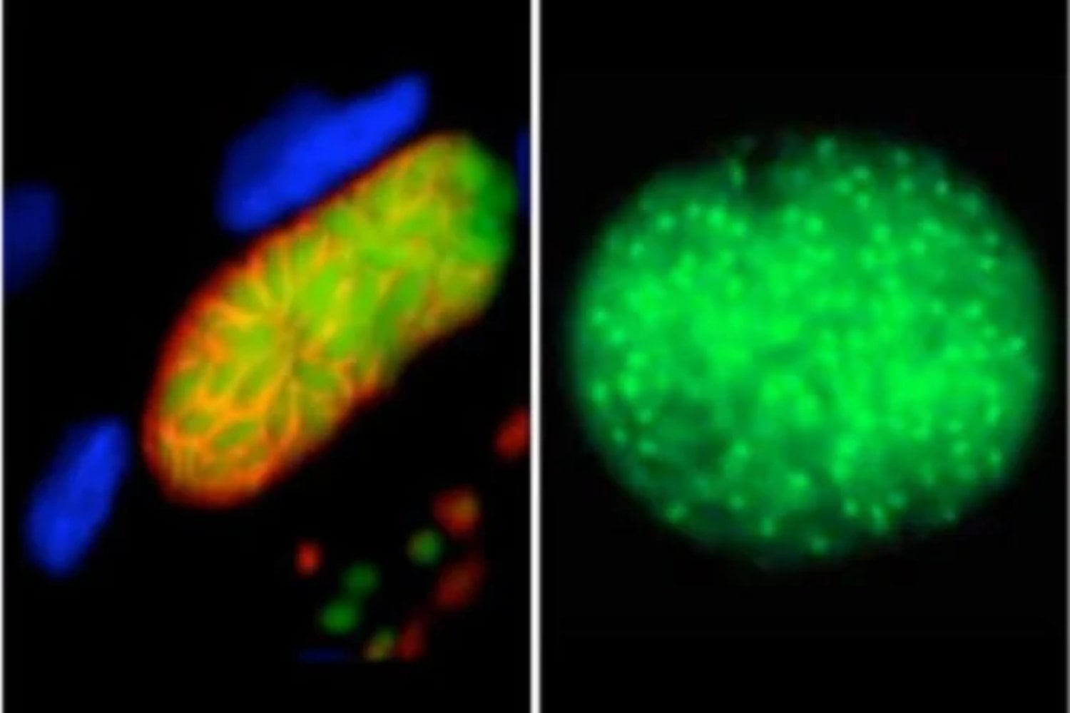 Un parásito infecta hasta a un tercio de la humanidad y puede esconderse durante años en el cerebro. Creíamos que sus quistes estaban dormidos, pero dentro ocurría algo mucho más extraño