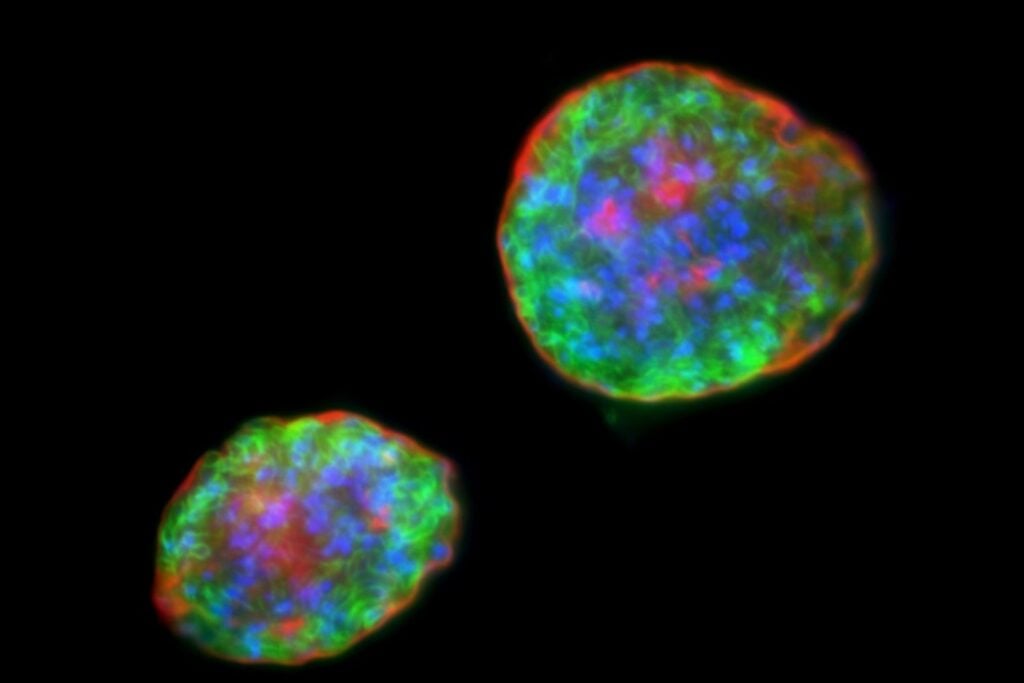 Un parásito infecta hasta a un tercio de la humanidad y puede esconderse durante años en el cerebro. Creíamos que sus quistes estaban dormidos, pero dentro ocurría algo mucho más extraño