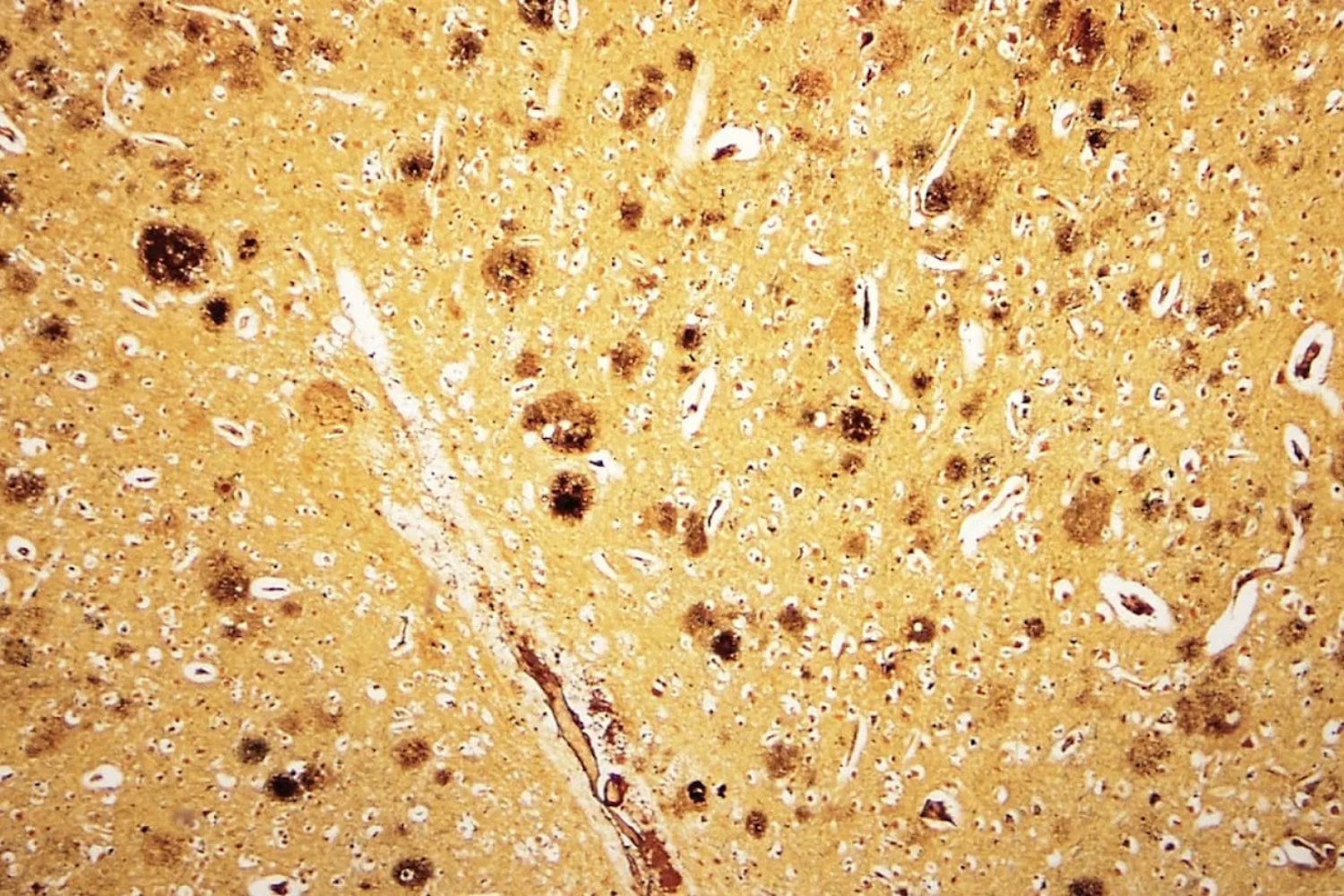 Google DeepMind calculó qué pasaría si cambiáramos una sola letra del ADN humano. El resultado es un mapa de 9.000 millones de mutaciones posibles que ocupa un petabyte