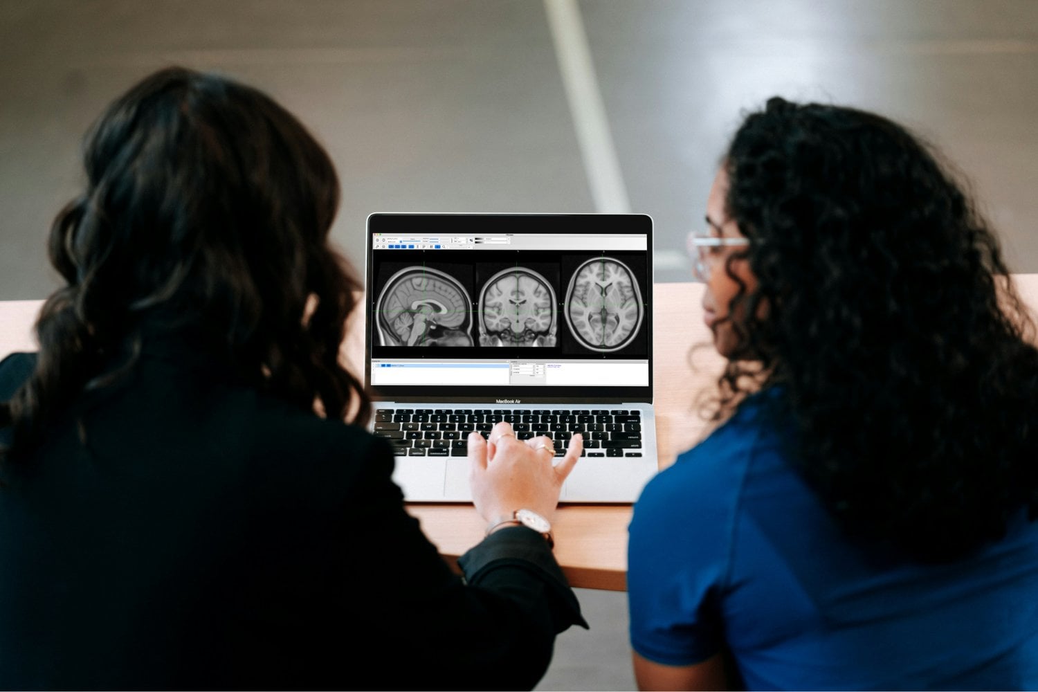 A los 24 años ocurre un cambio importante en el cerebro, pero no es el final del desarrollo
