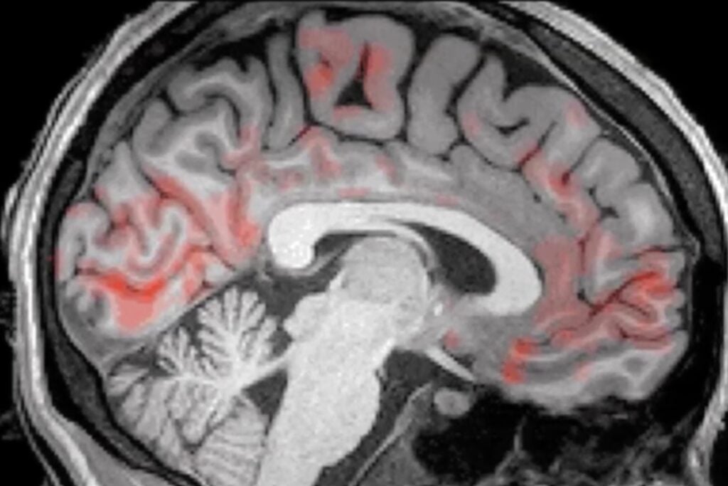 Un sonido suave durante el sueño puede potenciar el flujo que “limpia” el cerebro