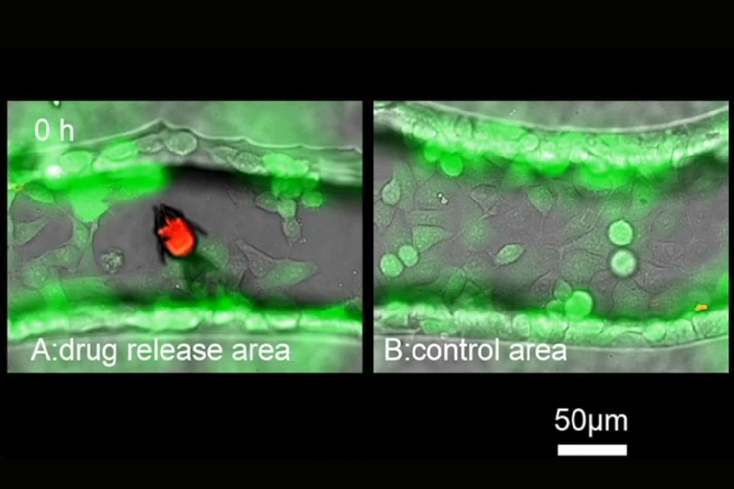 Microrrobots metálicos podrían realizar biopsias y administrar fármacos desde el interior del cuerpo