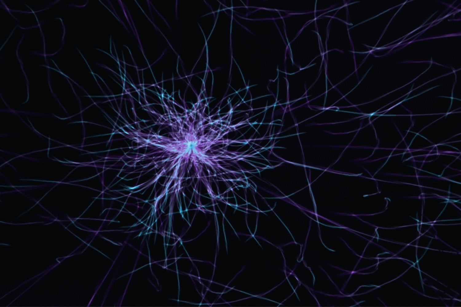 Neuronas