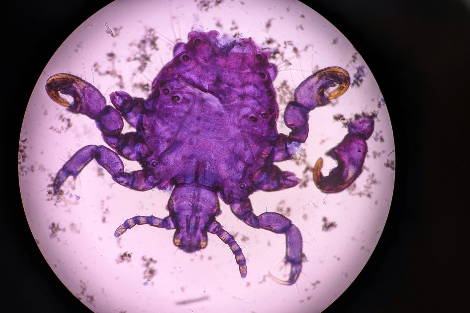 Parasito
