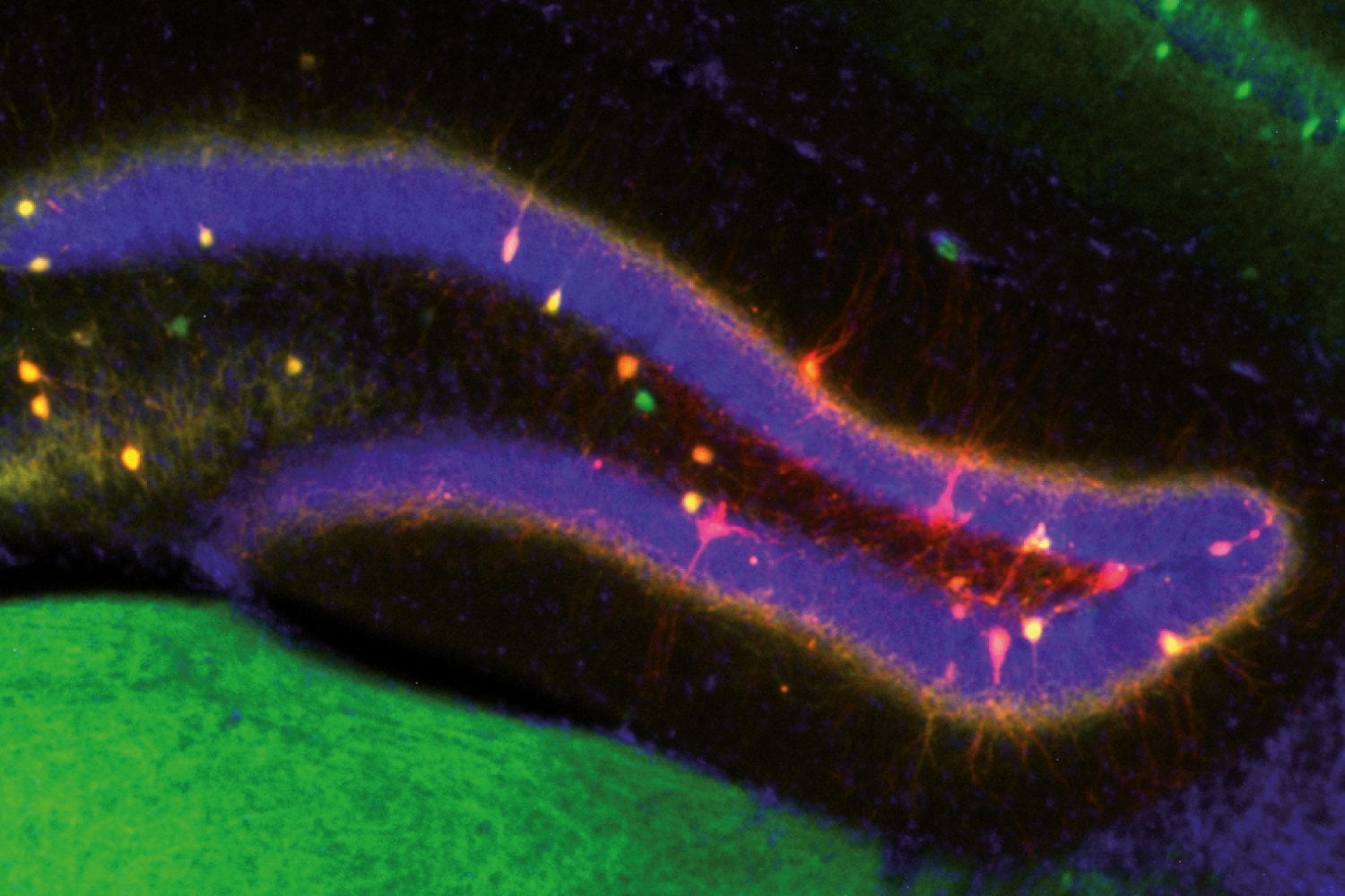 El cerebro tiene un dilema cada vez que recuerda: cambiar el recuerdo o protegerlo. Un experimento acaba de encontrar la pieza que inclina la balanza